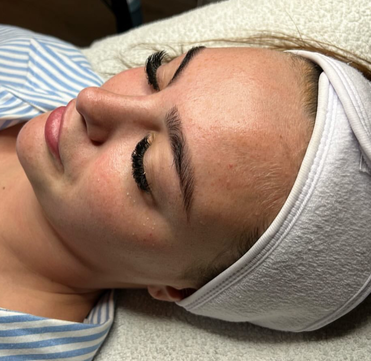 Fedederm Beauty Cilt Bakımı